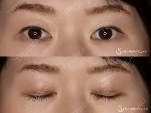 90 days after image
