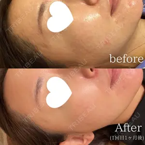 30 days after image