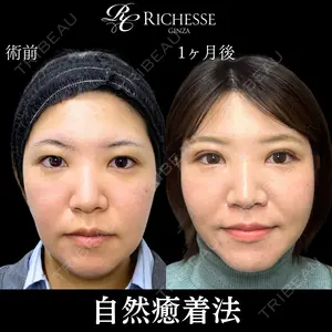 30 days after image