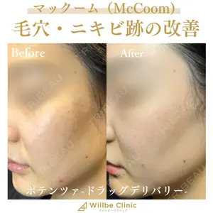 before image