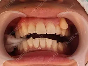 before image