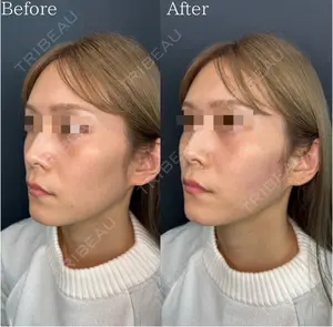 null days after image