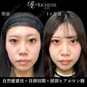 30 days after image