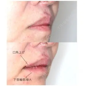 before image