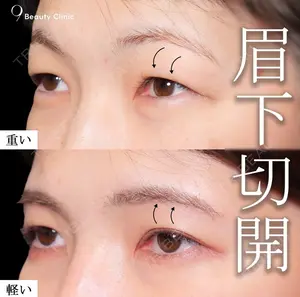 30 days after image