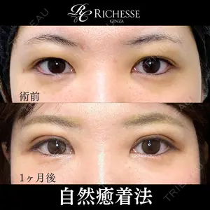before image