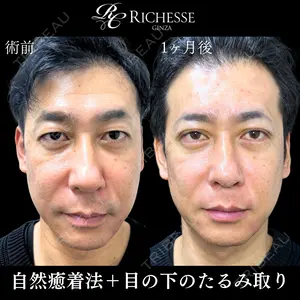 before image