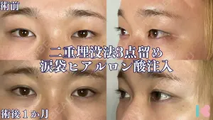 before image