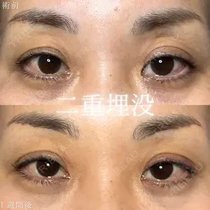 before image