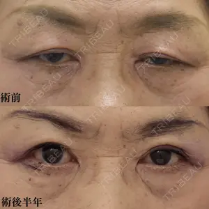 60 days after image