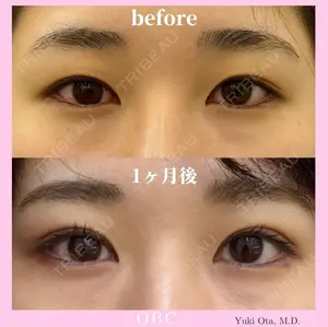 before image