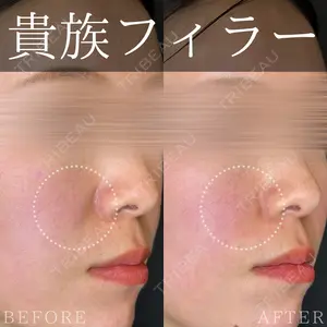 0 days after image