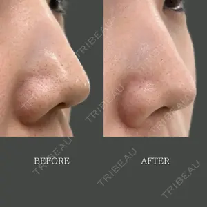 30 days after image
