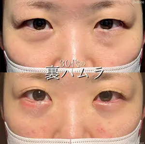 before image