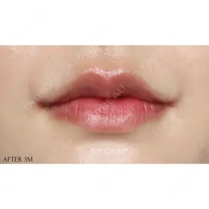 30 days after image