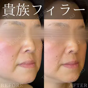 0 days after image