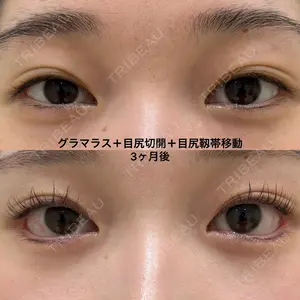90 days after image