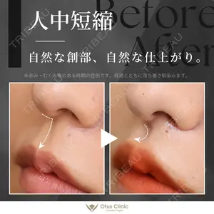 30 days after image