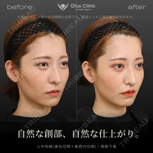 30 days after image
