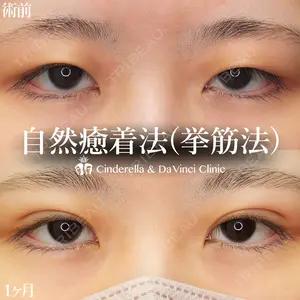 30 days after image