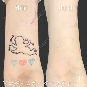 before image