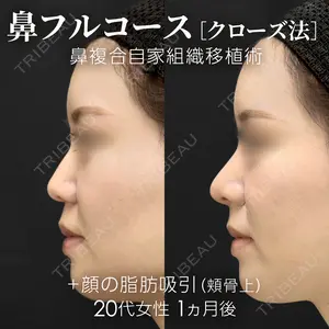 before image