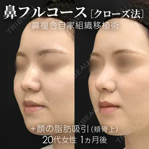 30 days after image