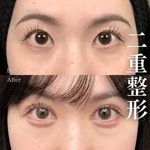 90 days after image