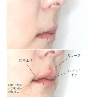 before image
