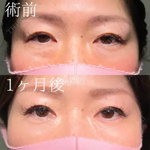 30 days after image