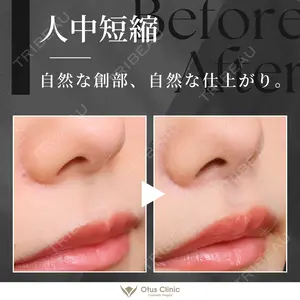 90 days after image