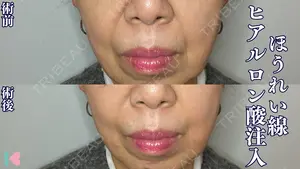 0 days after image