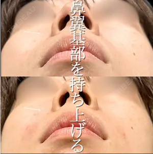 before image