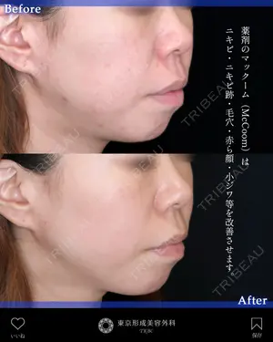 before image