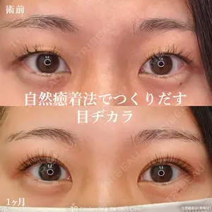 before image
