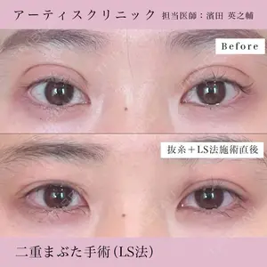before image