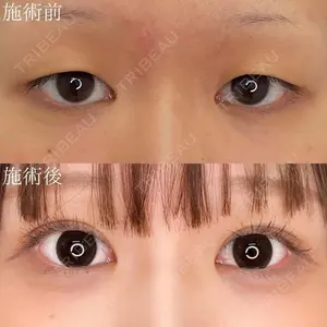 before image