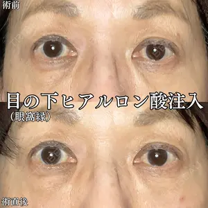 0 days after image