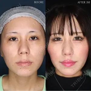 90 days after image