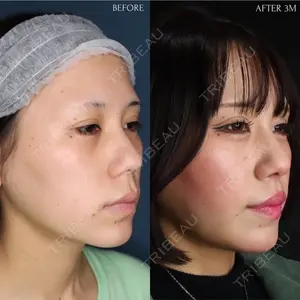90 days after image