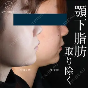 30 days after image