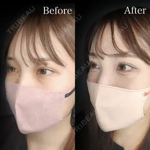60 days after image