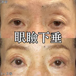 30 days after image