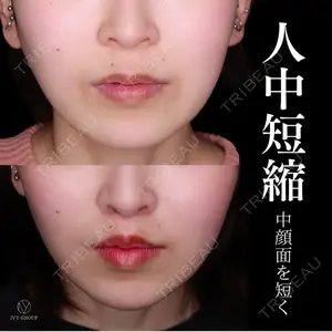 30 days after image