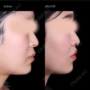 30 days after image