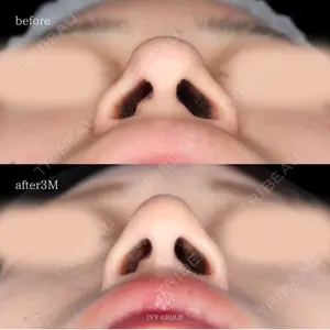 90 days after image