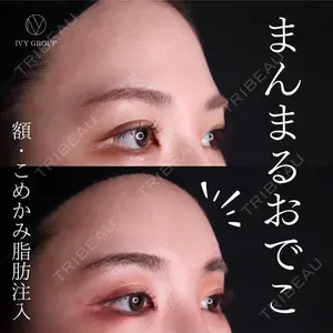 30 days after image