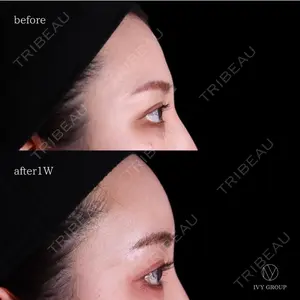 90 days after image