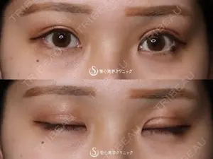 30 days after image