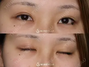 before image